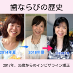 過食で虫歯から、回復して歯科矯正へ。摂食障害が治るということ